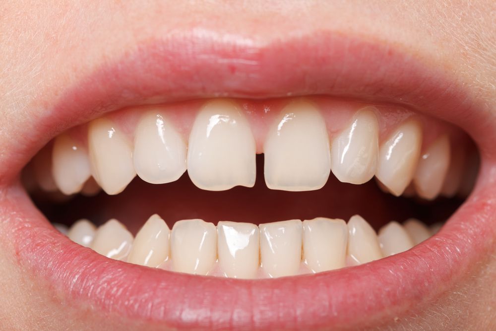dental caliari online